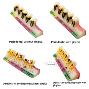 Modèle d'enseignement dentaire anatomique en résine pour implant dentaire, préparation au brossage des prothèses - Product Image 2