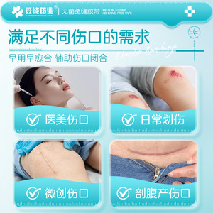 Parche médico Tuoneng sin sutura para reducir la tensión de la piel, para cierre de heridas de cesárea y cuidado de cicatrices infantiles - Product Image 1