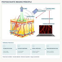 Source laser pulsée photoacoustique multi-longueurs d'onde en nanoseconde pour la recherche et la détection en ultrasons biomédicaux