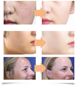 <span class=keywords><strong>Crema</strong></span> per il viso al miele di Manuka con etichetta privata lenitiva biologica che riduce le rughe e le cicatrici - Product Image 4