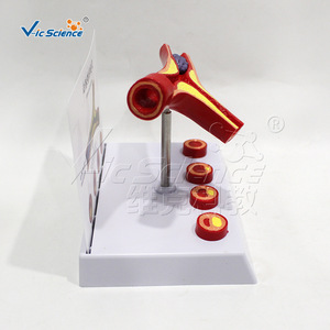 Modèle de vaisseaux sanguins bifurqués hautement réalistes, spécimen anatomique de branches de vaisseaux sanguins, modèle pédagogique pour les écoles de médecine. - Product Image 3