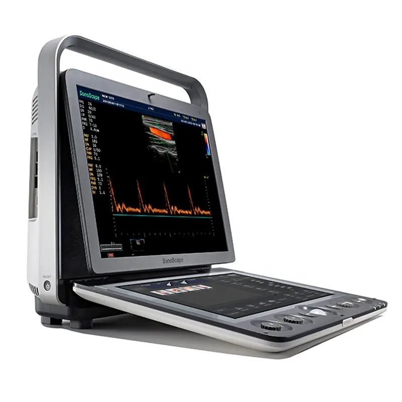 Sonoscape S9 Excellent Superb Portable Color Doppler 3D 4D Ultrasound Machine Portable Ultrasound Machine for Veterinary Use