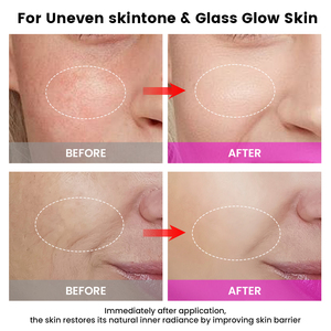 Appareil de beauté facial à domicile 2026 Nouveau tout-en-un <span class=keywords><strong>anti</strong></span>-âge, machine faciale <span class=keywords><strong>anti</strong></span>-acné, traitement liftant pour le <span class=keywords><strong>visage</strong></span> et le cou à domicile - Product Image 6