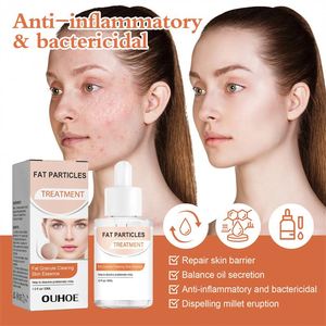 OUHOE - Esencia Facial de 30 ml para Eliminar Grasa y Granos, Tratamiento para Erupciones Cutáneas, Papules y Pústulas, Suero Facial - Product Image 5