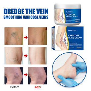 Relief Phle bitis Angiitis Dredge Vene Glatte Krampfadern Creme für Bein/Bein und Rückens ch merzen Linderung Creme - Product Image 4