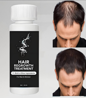Sérum tonique capillaire activateur de follicules 60 ml – Traitement épaississant pour la croissance des cheveux, ingrédients purs à base de plantes, approvisionnement de 6 mois