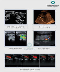 C60 उच्च ग्रेड 4d 5 डी कार्डियक इलास्टोग्राफी यूग क्लिनिक और अस्पताल अल्ट्रासाउंड मशीन - Product Image 2
