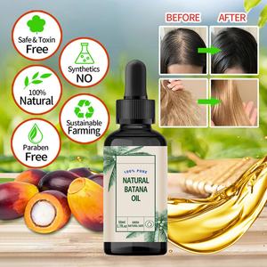 Huile Essentielle Capillaire 100% Pure et Naturelle de Batana, Personnalisée OEM, pour une Croissance Capillaire Plus Saine, Plus Épaisse et Plus Volumineuse - Product Image 5