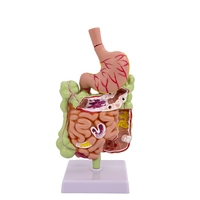 Modelo patológico de intestino grueso, lesiones gastrointestinales, modelo anatómico, enfermedad intestinal, modelo de lesiones de colon humano