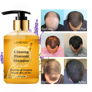High Quality Oem Herbal Natural Ginseng Anti-loss Instant Promote <strong>Hair</strong> Growth <strong>Korean</strong> Ginseng Blossom <strong>Shampoo</strong> <strong>for</strong> Women and <strong>Men</strong> - Product Image 1