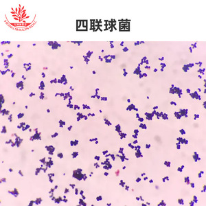 Cinco tipos de coxoides: comprensión preliminar de la morfología en la escuela de medicina; observación clara de bacterias microbianas - Product Image 1