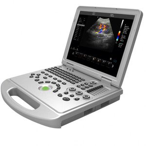 Prix de la machine à ultrasons portable Scanner à ultrasons portable sans fil à ultrasons 4d - Product Image 1