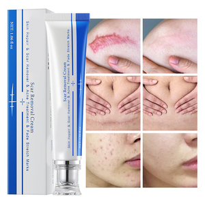 Venta al por mayor de acné, espinillas, estrías, cicatrices, reparación, eliminación de cicatrices, crema para eliminar cicatrices, crema para eliminar cicatrices corporales - Product Image 3