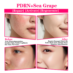 Mascarilla Facial Reparadora de Marca Privada, Reduce las Líneas Finas y Restaura la Elasticidad de la Piel, Mascarilla Reparadora PDRN de Uva de Mar - Product Image 4