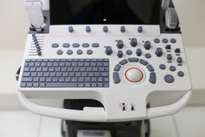 Diagnostic assisté par l'IA <span class=keywords><strong>Sonoscape</strong></span> P40 Elite Machine à ultrasons Doppler couleur numérique 3D 4D Maquina De Ultrasonido pour la cardiologie - Product Image 4