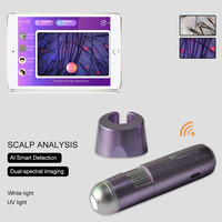 Analizzatore Digitale ad Alta Definizione per Cuoio Capelluto 50X 200X con Messa a Fuoco Manuale, Rilevatore di Follicoli per la Cura Professionale del Cuoio Capelluto e la Detox