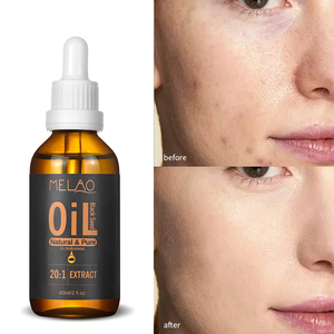 Huile de Nigelle Personnalisée à 5% de Thymoquinone, Extrait 20:1 pour la Croissance de la Barbe et des Cheveux, Huile Naturelle Nourrissante pour la Peau et Réparatrice de la Barrière Cutanée - Product Image 5