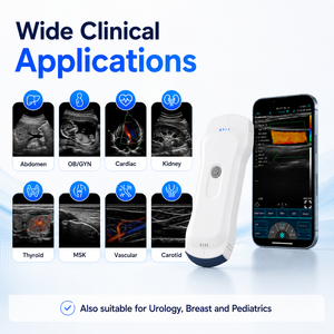Sonda USB WiFi 3 en 1 para Uso Veterinario Clínico, Ecógrafo <span class=keywords><strong>Doppler</strong></span> Color Portátil - Product Image 4