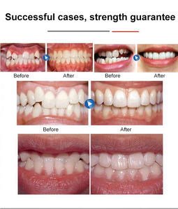 Retenedor de ortodoncia, <span class=keywords><strong>Corrector</strong></span> de dientes, 3 etapas, alisado <span class=keywords><strong>Dental</strong></span>, entrenador de plástico para uso doméstico, caja de molienda de dientes, embalaje - Product Image 4