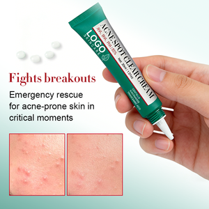 Crème anti-acné OEM de haute qualité : Réduit les éruptions cutanées, soulage les rougeurs, retient l'hydratation, action rapide, éclaircit les taches brunes - Product Image 4