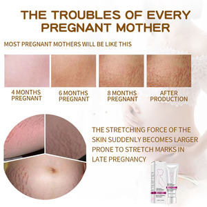 Crème anti-vergetures de marque privée, best-seller, pour femmes, naturelle, biologique, à l'aloe vera, crème anti-vergetures après l'accouchement - Product Image 3