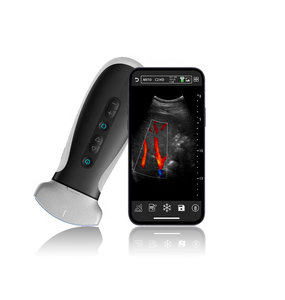 Android WiFi portatile Mini Dual-Head sonda senza fili Doppler a colori Scanner ad ultrasuoni veterinario dispositivi di monitoraggio - Product Image 5