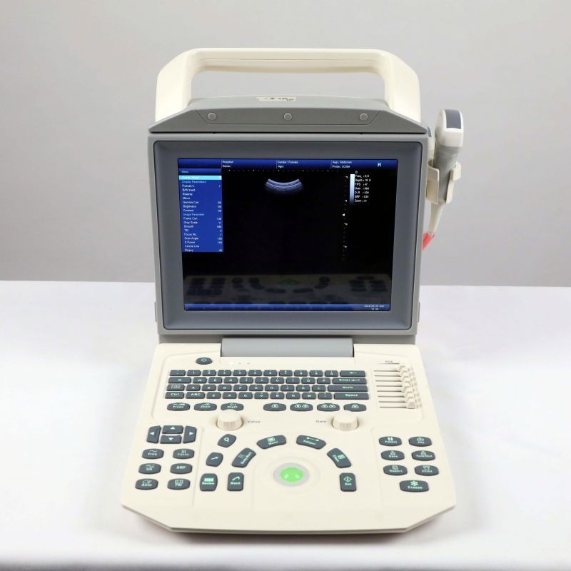 Portable Digital X Ray Machine for
