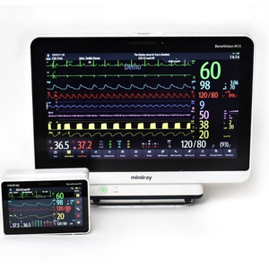 Monitor Multiparamétrico Veterinario Mindray BeneVision N15, Pantalla Táctil FHD de 15.6 Pulgadas para UCI/Quirófano/Anestesia Veterinaria - Product Image 4
