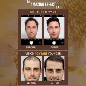 Commercio all'ingrosso olio biologico per la crescita rapida dei capelli per crescere il siero dei capelli riparazione follicolo Anti trattamento di perdita per la cura dei capelli ricrescita olio di essenza - Product Image 2