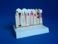 Modèle de dent en PVC anatomique pour l'enseignement dentaire, anatomie des dents et des gencives, taille