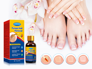 2025 Venta caliente OEM ODM onicomicosis eliminar <span class=keywords><strong>hongos</strong></span> y mejorar las uñas <span class=keywords><strong>de</strong></span> los <span class=keywords><strong>pies</strong></span> y las uñas líquido cuidado <span class=keywords><strong>de</strong></span> las uñas <span class=keywords><strong>de</strong></span> los <span class=keywords><strong>pies</strong></span> - Product Image 6