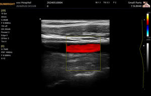 Laptop Full Digital Ultrasound Scanners Ultrassom Portátil Doppler Colorido - Product Image 2