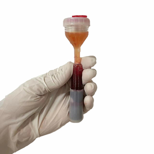 PET-Material Y-Typ PRP-Röhrchen mit überlegener Klarheit | Entwickelt für präzise ortho pä dische und Haar wiederherstellung anwendungen - Product Image 3