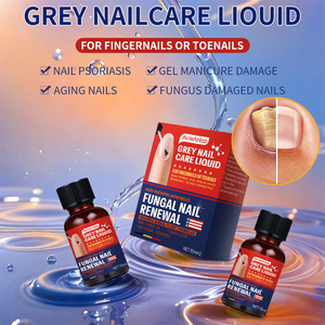 New Arrival 7 Days Nail Fungus <strong>Treatment</strong> Serum Treast Fungus Bacteria Repair Damage Nail Grey Nail Care Essence Oil <strong>Treatment</strong> - Product Image 2