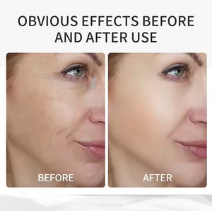 Tinh chất Collagen thương hiệu tự sở hữu giúp tăng cường độ đàn hồi của da, giảm nếp nhăn sâu và tạo ra làn da trẻ săn chắc - Product Image 4