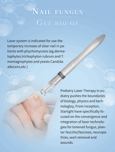 Huamei 980nm Diodo Láser Eliminación de enrojecimiento Eliminación de venas de araña Eliminación <span class=keywords><strong>vascular</strong></span> Máquina láser de 980nm - Product Image 5