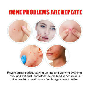 Patch anti-imperfections invisible Jaysuing Cloud, infusé à l'acide salicylique, soin de la peau, patch anti-boutons pour le nez et le corps, réparation douce des muscles - Product Image 2