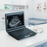 Ordinateur portable abordable de 10,4 pouces JM-808S, échographie vétérinaire portable pour le diagnostic clinique