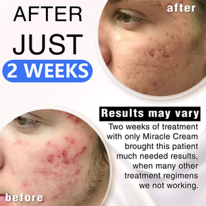 Crème pour le visage à l'urée et à la vitamine E en gros pour femmes, hydratante et éclaircissante, réparation de la peau, allantoïne, glycérine, lotions et crèmes aqueuses - Product Image 6