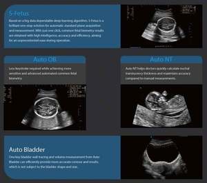 Appareil d'échographie Doppler couleur Sonoscape P11Elite <span class=keywords><strong>4D</strong></span>/5D avec fonction IA, chariot, pour les veines, le bébé, l'abdomen - Product Image 4