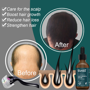 Miễn phí Mẫu nhanh chóng hiệu quả tăng trưởng tóc dầu giúp tóc mọc lại thiết lập cho phụ nữ da đen - Product Image 5