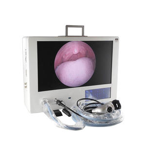 JOYMED, Endoscopio Médico Integrado, Diagnóstico Urológico, Cirugía, Imagen HD Clara, 24 Pulgadas, Fuente de Energía Eléctrica Todo en Uno - Product Image 2