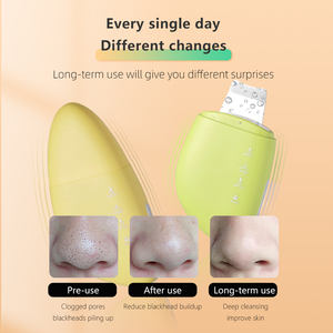 Mini appareil de peeling galvanique à haute fréquence pour l'exfoliation des points noirs, machine de peeling à l'eau pour le visage et l'élimination du sébum du nez - Product Image 4