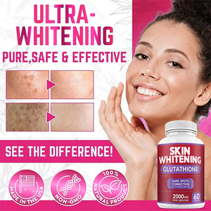 Oem/odm יופי תוספת עור הלבנה כמוסות העור טיפול glutathion כמוסות העור הטוב ביותר הלבנה גלולות כמוסות לנשים - Product Image 5