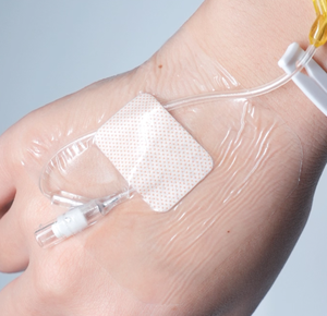 उच्च गुणवत्ता वाले डिस्पोजेबल पारदर्शी अंतःशिरा कैथीटर ड्रेसिंग थोक प्रमाणित वर्ग i वाटरप्रूफ घाव ड्रेसिंग - Product Image 4