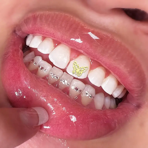 Oferta Especial: Gemas Dentales de Mariposa Sin Plomo, Piedras de Cristal de Varios Colores y Formas, Kit de Joyería Multiusos para Higiene Bucal - Product Image 5