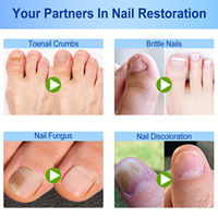 SEFUDUN Patchs de réparation rapide et efficace pour les ongles des pieds, bandes multi-usages pour le traitement des ongles incarnés et des mycoses, patchs de correction des ongles des orteils