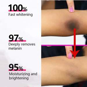 Crema Schiarente per il Corpo con Vitamina C, Rimuovi Macchie Scure per Ascelle, Ginocchia e Gomiti, Crema Sbiancante per il Corpo, Produzione Cosmetica - Product Image 3