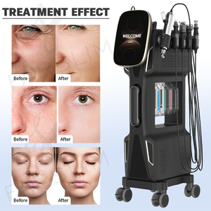 Equipo Facial 9 en 1: Burbujas Faciales + Mesoterapia Nano + Limpieza con Burbujas + Rodillo de Velocidad Ajustable + Burbujas de Oxígeno + Inyección de Oxígeno - Product Image 4