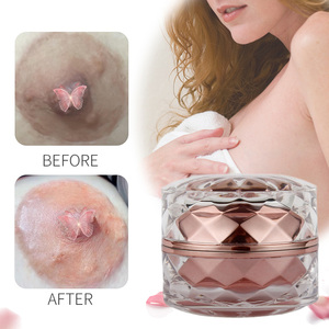 Crema blanqueadora para áreas íntimas, axilas, bikini, elimina manchas oscuras, aclara pezones y realza el color de la piel. - Product Image 3